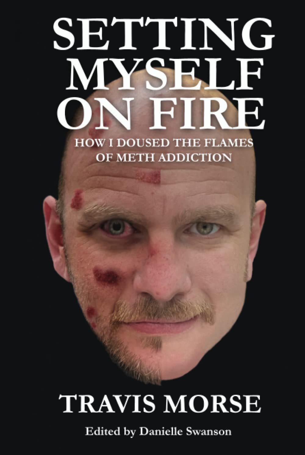 Setting Myself On Fire: How I Doused The Flames Of Meth Addiction - 2279