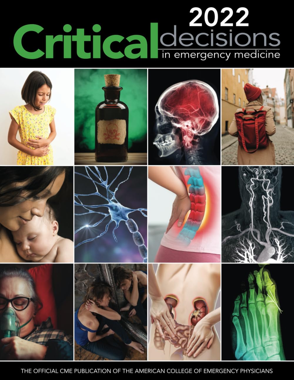 2022 Critical Decisions in Emergency Medicine: The Official CME Publication of the American College of Emergency Medicine (Critical Decisions in Emergency Medicine Annual Collection) - 7920