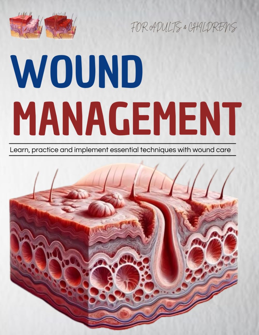 Wound Management For Adults & Childrens : Learn, Practice and Implement Essential Techniques With Wound Care - 9366