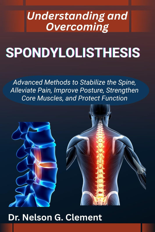 UNDERSTANDING AND OVERCOMING SPONDYLOLISTHESIS: Advanced Methods to Stabilize the Spine, Alleviate Pain, Improve Posture, Strengthen Core Muscles, and Protect Function