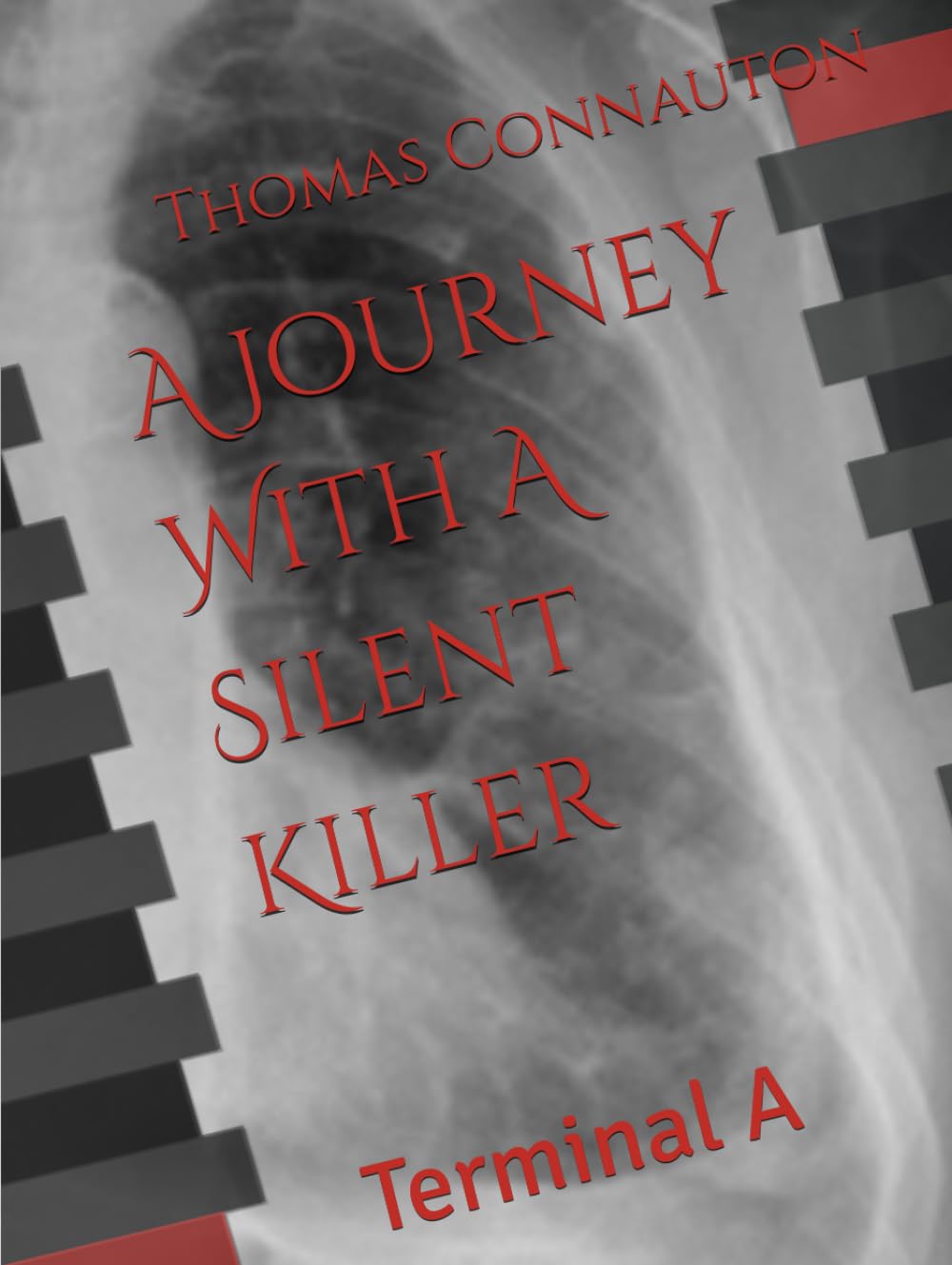 A Journey With A Silent Killer: Terminal A