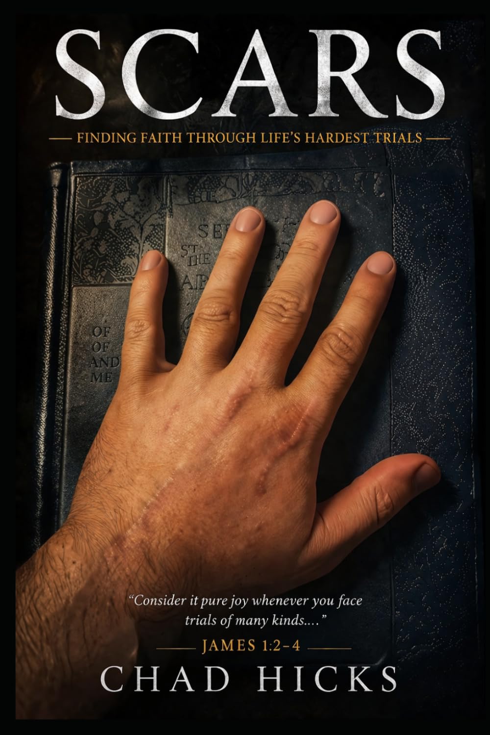 SCARS: FINDING FAITH THROUGH LIFE'S HARDEST TRIALS