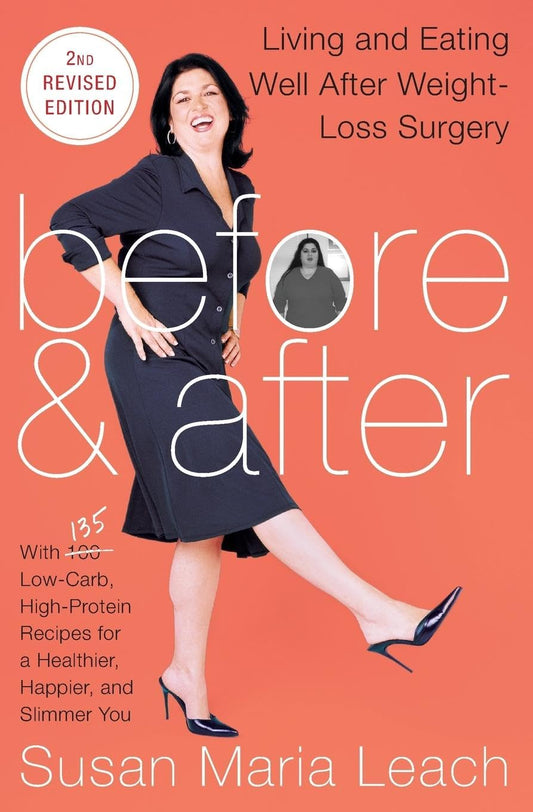Before & After, Second Revised Edition: Living and Eating Well After Weight-Loss Surgery - 6516